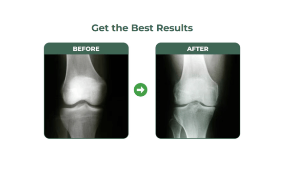 Move Well Daily before & after